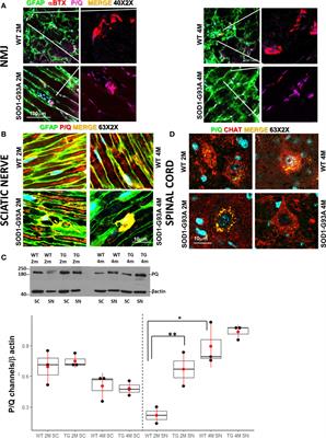 Very Early Involvement of Innate Immunity in Peripheral Nerve Degeneration in SOD1-G93A Mice